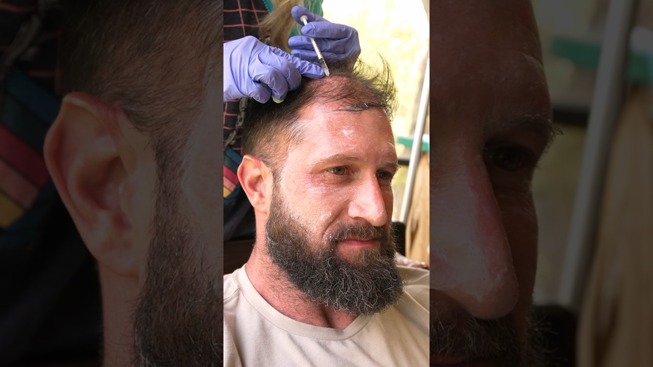 Hair Loss & Weight Loss YouTube Thumbnail