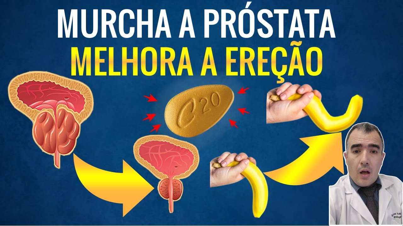 O remédio que MURCHA A PRÓSTATA e melhora SUA EREÇÃO
