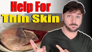 How to TREAT and PREVENT thinning skin | + Thin Skin on Face and Neck | Chris Gibson