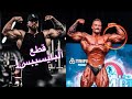 إصابة كريس بامستيد فالبايسيبس - نهايته أم أحسن لاعب عالكوكب؟