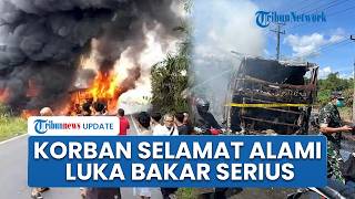 4 Korban Selamat Kecelakaan Bus ALS Vs Truk Tangki BBM Alami Luka Bakar Serius, Dirawat Intensif