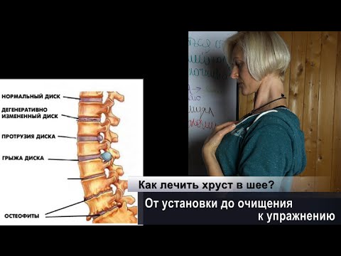 Боли в шее и голове в горизонтальном положении Что за боли тянущие в спине