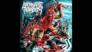 Abominable Putridity - The Anomalies Of Artificial Origin (Remixed & Remastered) (2015) (FULL ALBUM)