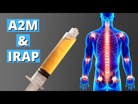 A2M And IRAP Injection For Joint Arthritis | Alpha-2 Macroglobulin And Interleukin-1 Recepter Antag