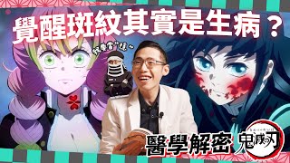 [鬼滅] 斑紋=網狀青斑？