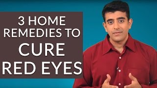 3 Effective Home Remedies To GET RID Of RED EYES