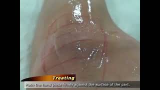 Underarm Whitening Treatment Dubai & Abu Dhabi | Flawless Whitening Cost