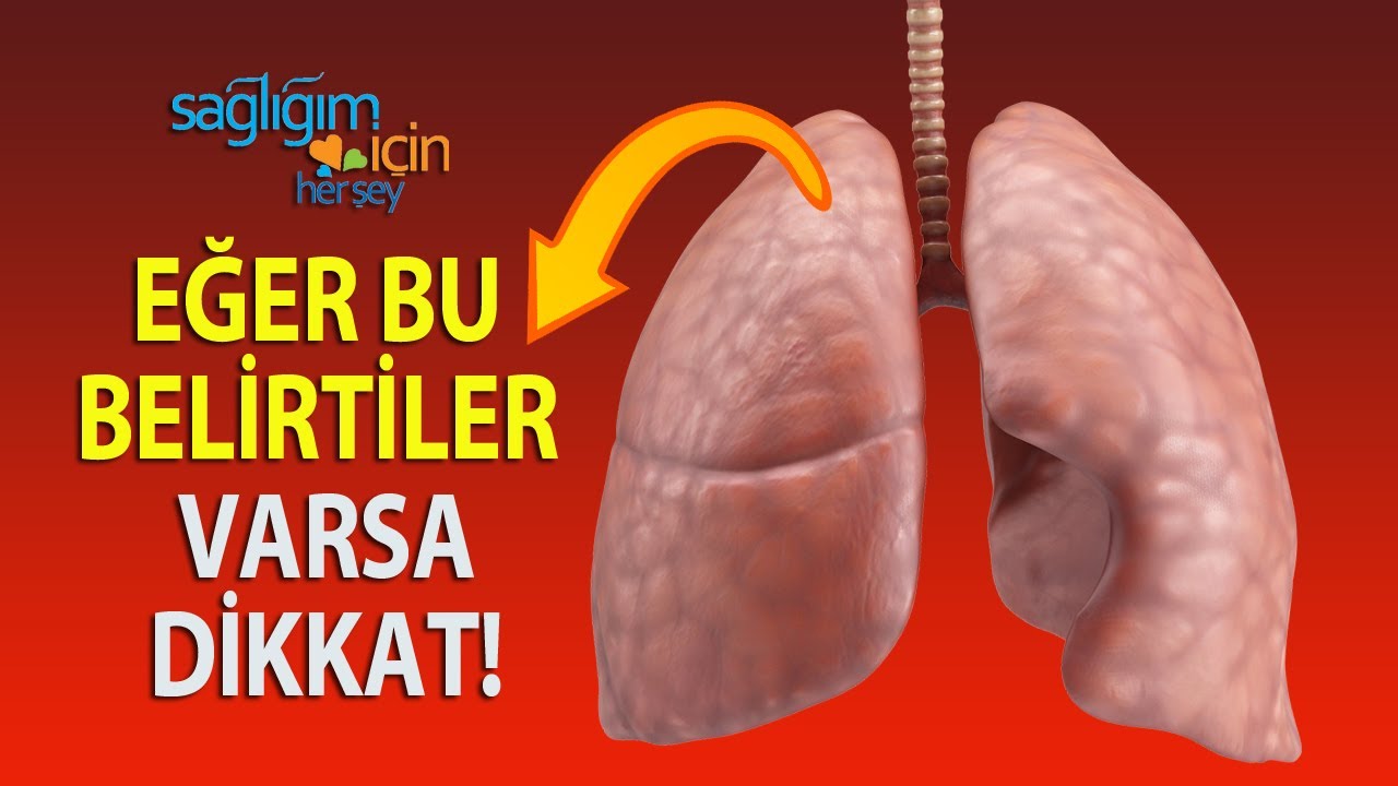 Akciğer Kanseri Kimlerde Görülür, Belirtileri Nelerdir?