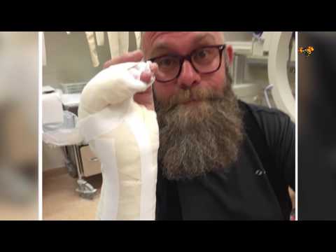 Radioprofilen skadad i motorcykel-olycka