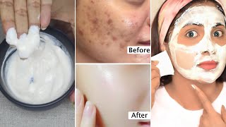 3 Days Skin Transformation-Get rid of skin blemishes, spots, large pores-get bright tight glass skin