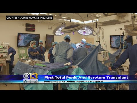Mărirea penisului cu intervenție chirurgicală