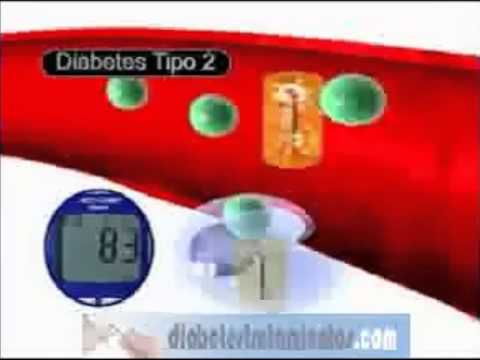 Si el caviar rojo con diabetes tipo 2 Programa de la diabetes en los adolescentes