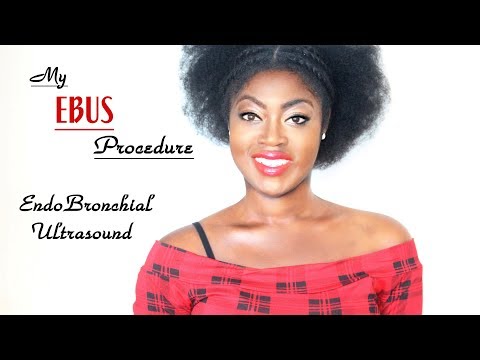 My Ebus Procedure - EndoBronchial  Tay AutoImmune