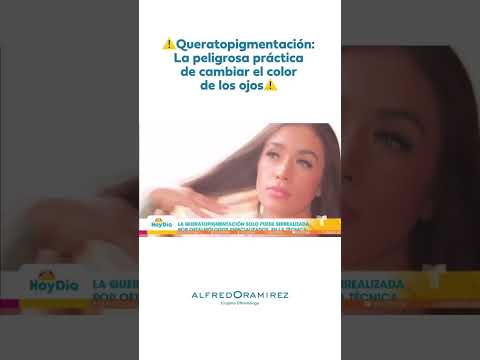 Queratopigmentación Cartagena cirujano oftalmólogo Alfredo Ramírez