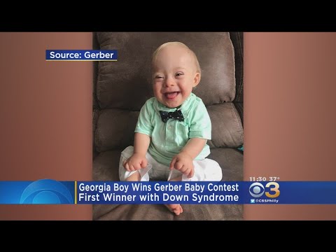 2018 Gerber Baby, Lucas, Is First Gerber Baby With...