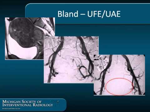 Into to IO by Dmitry Goldin MD