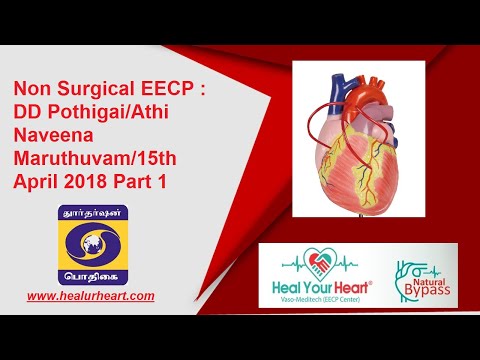 Non Surgical EECP Treatment | DD Pothigai Athi Naveena Maruthuvam | 15 April 2018 Part 1