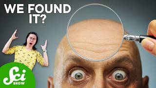 Can Baldness Be Reversed?