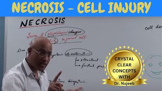 Necrosis - Cell Injury - General Pathology