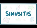 Sinusitis - causes, symptoms, diagnosis, treatment, pathology