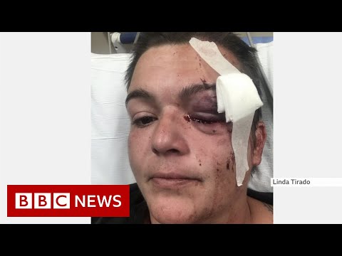 ジョージ・フロイド：抗議デモで記者を襲撃 - BBCニュース (George Floyd: attacks on reporters at protests - BBC News)