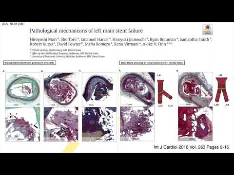 DK crush vs. Culotte in bench - Dr Yutaka HIKICHI