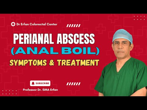Ropień okołoodbytniczy (czyrak odbytu) – wyjaśnienie | Objawy, leczenie i ryzyko przetoki | Prof....