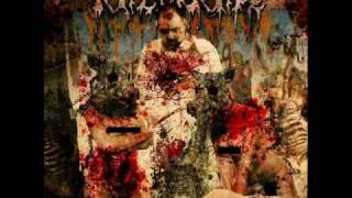 Razor Rape - -ballsack blastfuck.wmv