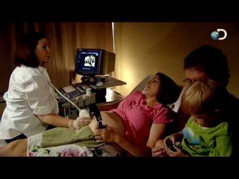 Mood Swings | Curiosity: Life Before Birth