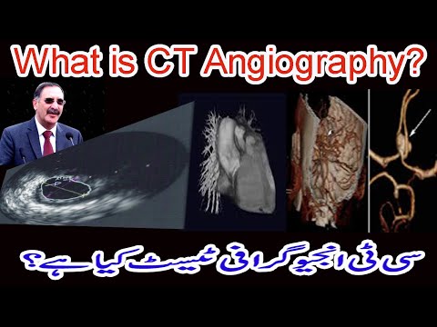 CT Angiography Test / MSCT Angiography Test kia hai / CT Angiogram