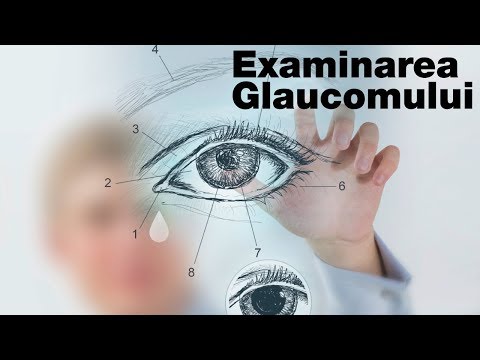 glaucomul este posibil să restabilească vederea cu