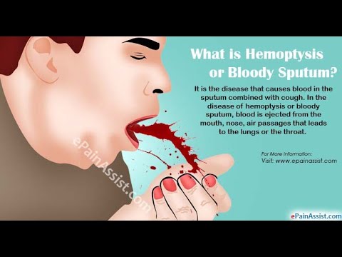 hemoptysis hipertóniával