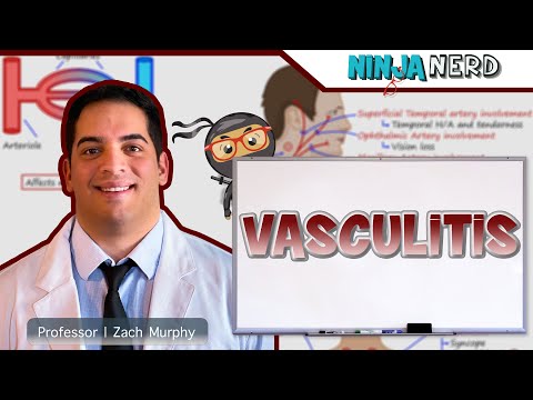 Vasculitis | Clinical Medicine