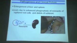 Dr Azza   Protozoa 7    plasmodium  malaria    YouTube1