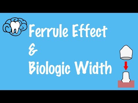 Ferruleneffekt und biologische Breite