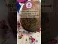 How To Get Rid Of CRADLE CAP On Baby S Scalp Naturally