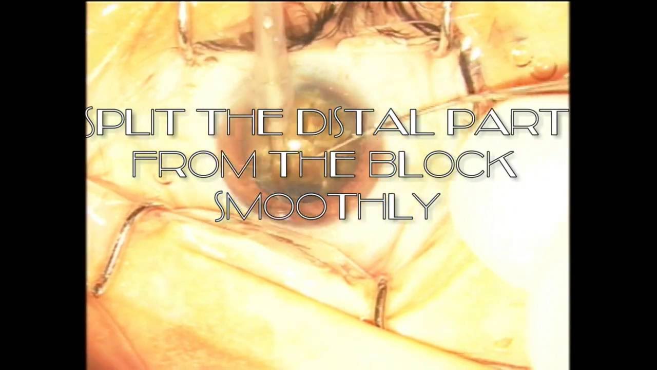 Andre Lins De Medeiros .-7