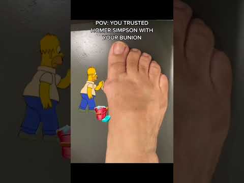 Will you trust homer simpson with your bunion?