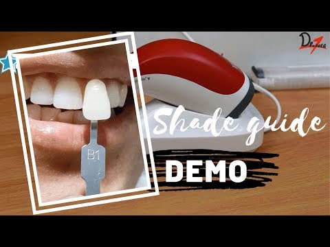 image-What shade is the most common tooth color?