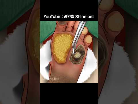 ASMR Satisfying Foot Care Animation🎄#asmr #care #relax #satisfying