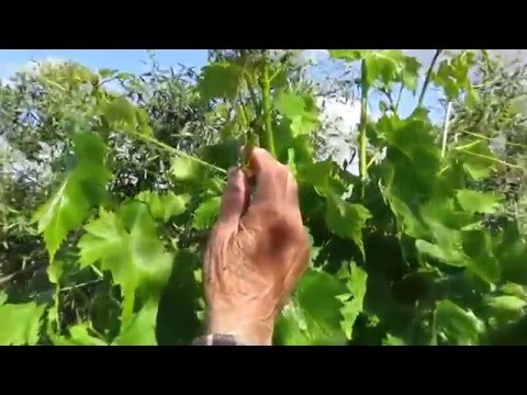 Inferiori del bacino di mal di schiena Osteocondrosi in segmenti di C4-C7