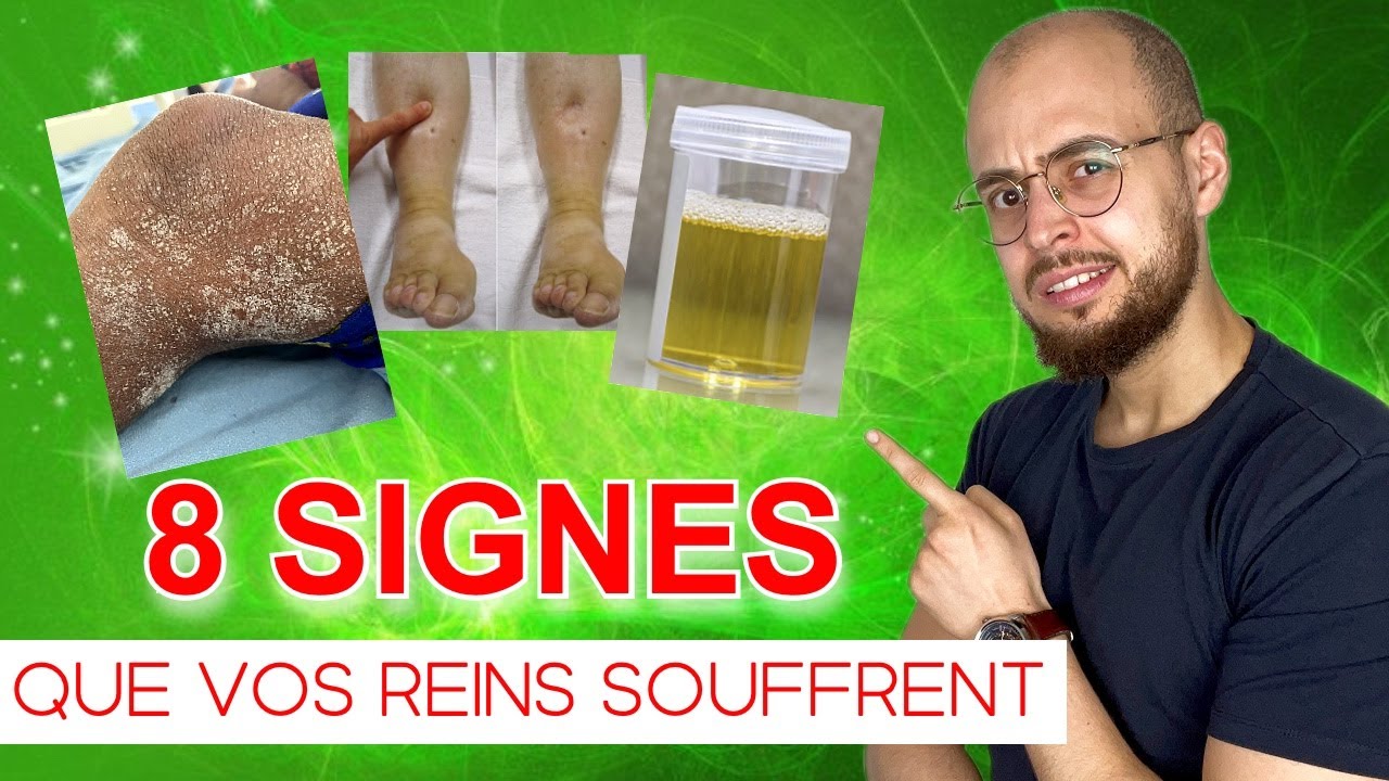 8 Signes d'INSUFFISANCE RÉNALE