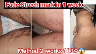 Stretch mark removal / How to remove Stretch marks (2nd Method) #stretchmarks #scars #diy