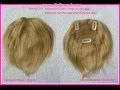 Hairpieces for thinning hair or alopecia