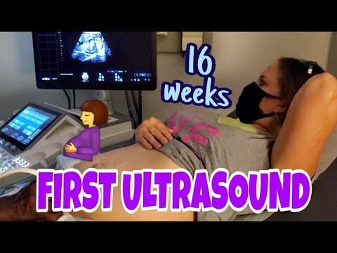 MY FIRST ULTRASOUND AT 16 WEEKS PREGNANT 🤰😍