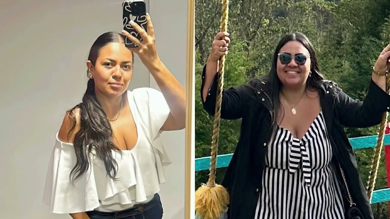 ¡Perdí 60 kilos y recuperé mi vida! | Testimonio cirugía bariátrica en Colombia 🇨🇴