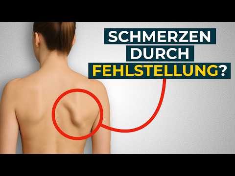 Train away protruding shoulder blades (scapula winged)