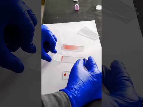 Blood smear preparation || how to make perfect smear #shortsfeed #shortsvideo