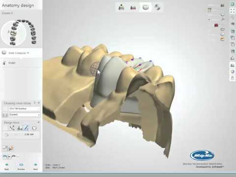 Intro to Dental CAD/CAM - Plan