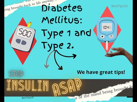 Diabetes Mellitus: A Guide for You. Diabetes Mellitus Type 1 and Type 2 . Does Sugar Defender work?